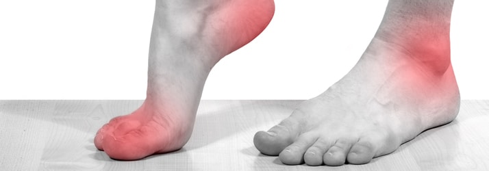 red marking pain in feet